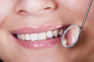 Smiling woman with dental mirror reflecting teeth.