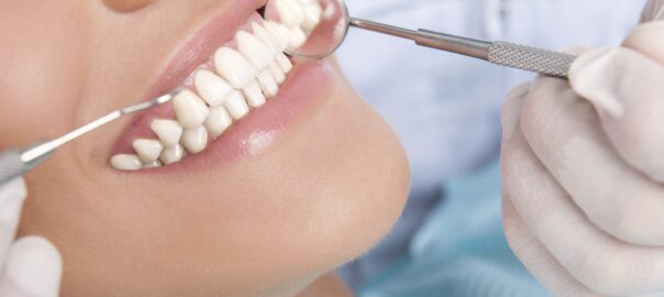 Dentist examining patient's teeth with tools.