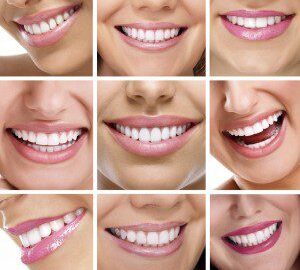 Collage of smiling women showcasing bright smiles.